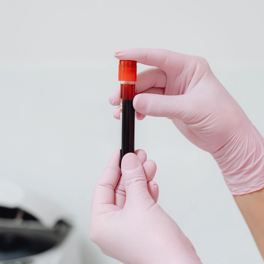 BNP-Test: Welcher BNP-Schnelltest ist der richtige?