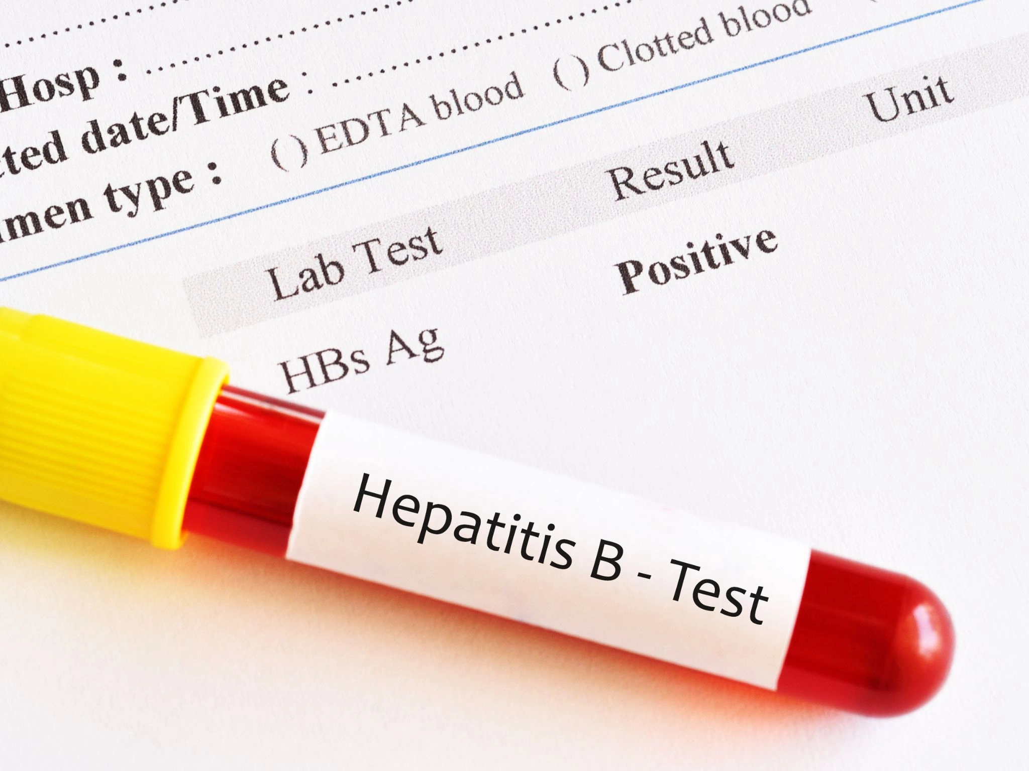 Hepatitis-B-Test: Labor, Schnelltest und Point of Care im Vergleich