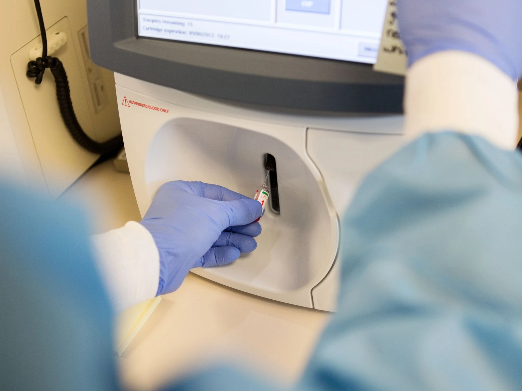 pH-Wert im Blut: Normwerte und klinische Bedeutung