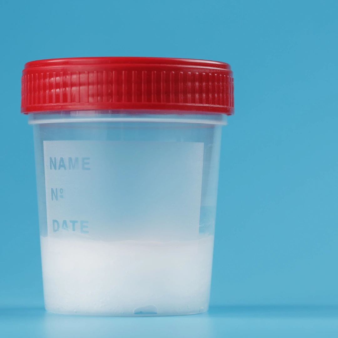 Spermienanalysegerät