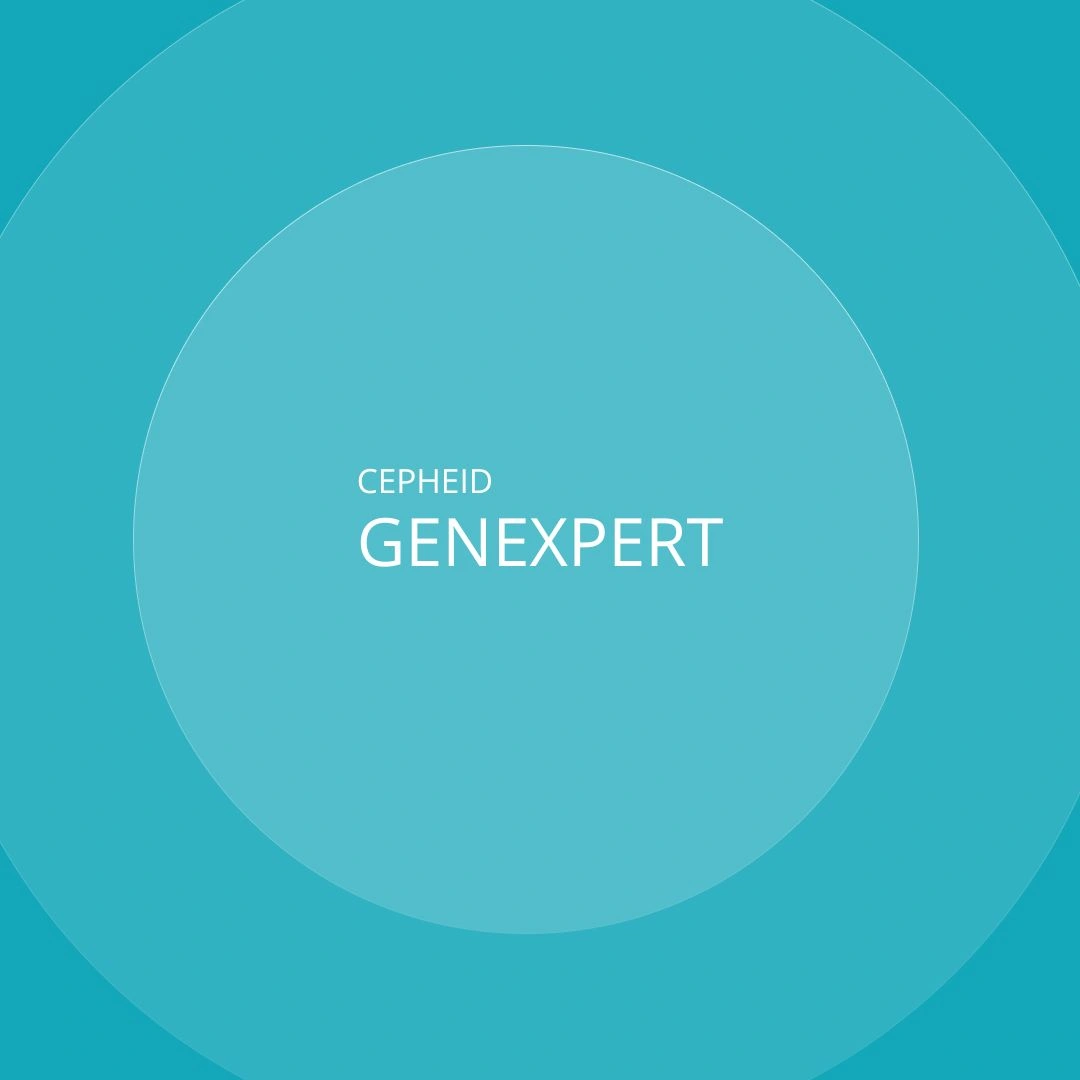 GeneXpert II und IV: Was kann die PCR-Plattform von Cepheid?