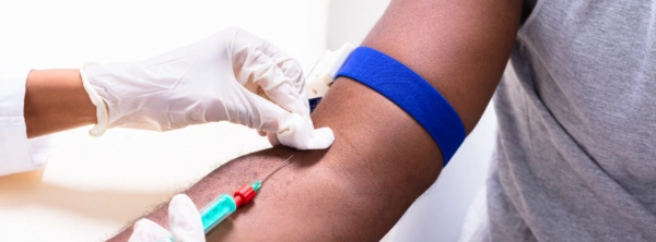 Arterielle BGA: Normwerte und Interpretation