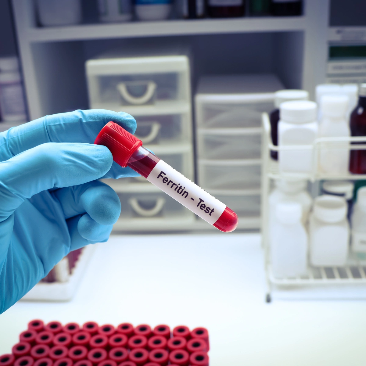 Ferritin Messgerät: POCT-Auswahl für Praxis und Apotheke