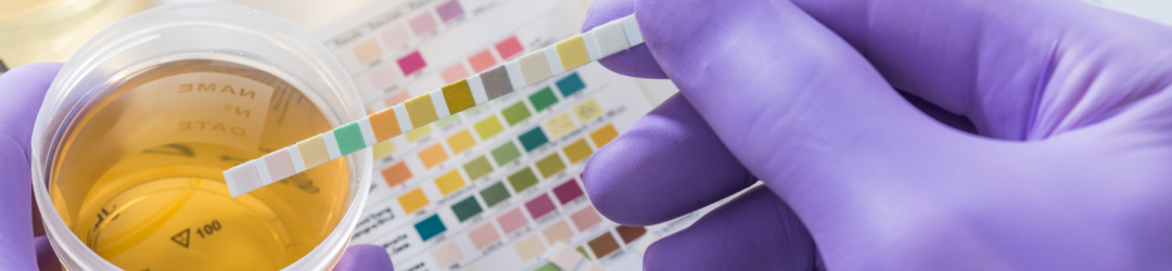 Urin Test