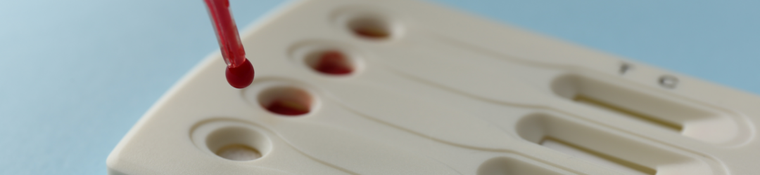 Syphilis Treponema pallidum