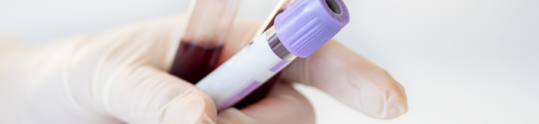 Troponin Test
