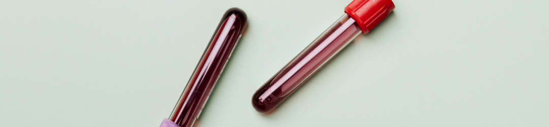 grosses blutbild werte