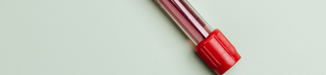 kleines blutbild werte